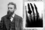 Wilhelm Conrad Roentgen y una radiografía (Foto multimedia)