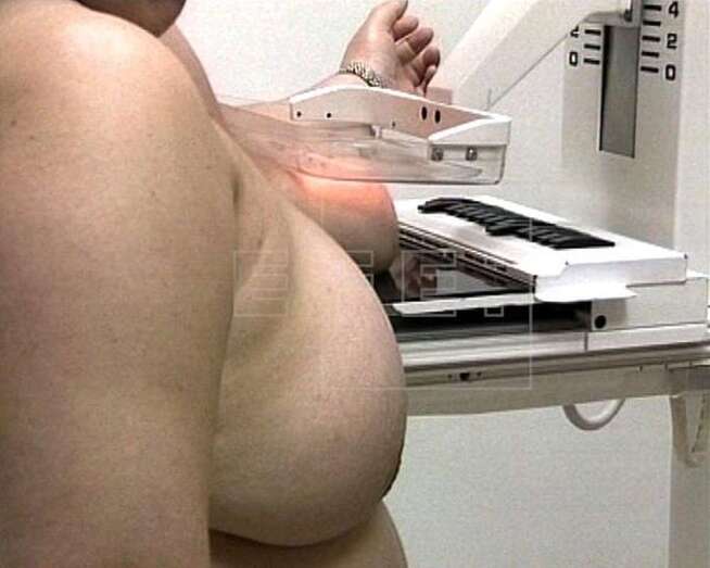 Imagen de archivo de una mamografía (Foto Efe)