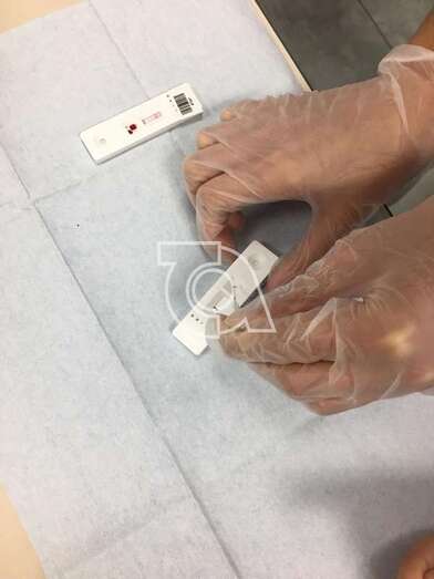 Prueba para el estudio sobre la prevalencia de virus (Foto TA)