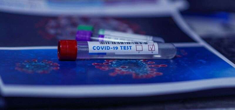 Prueba de Covid-19/TA