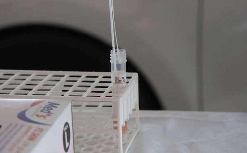 Prueba de Covid-19/TA