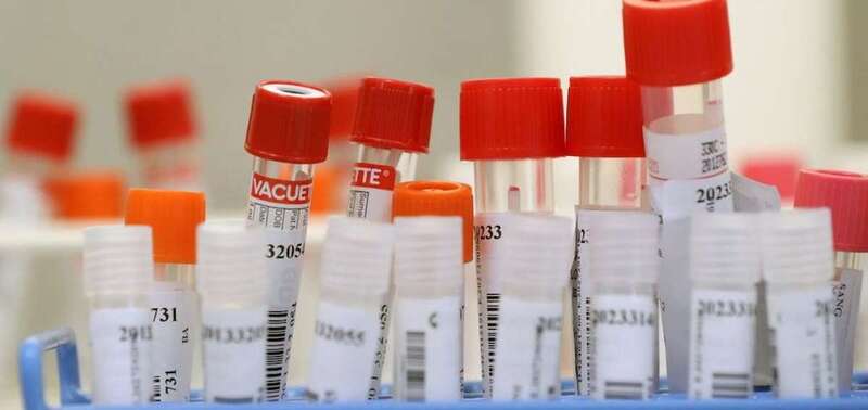 Prueba de Covid-19/TA