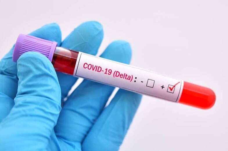 Variante Delta Plus de Covid-19/TA.