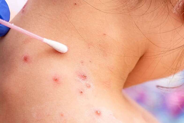 Persona afectada por la enfermedad/Multimedia.