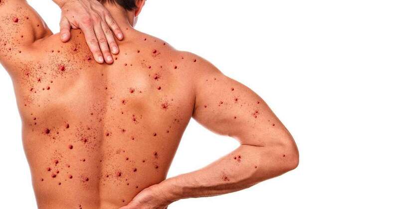 Persona afectada por la enfermedad/TA.