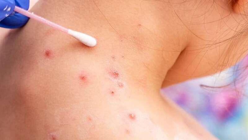 Persona afectada por la enfermedad/Multimedia.