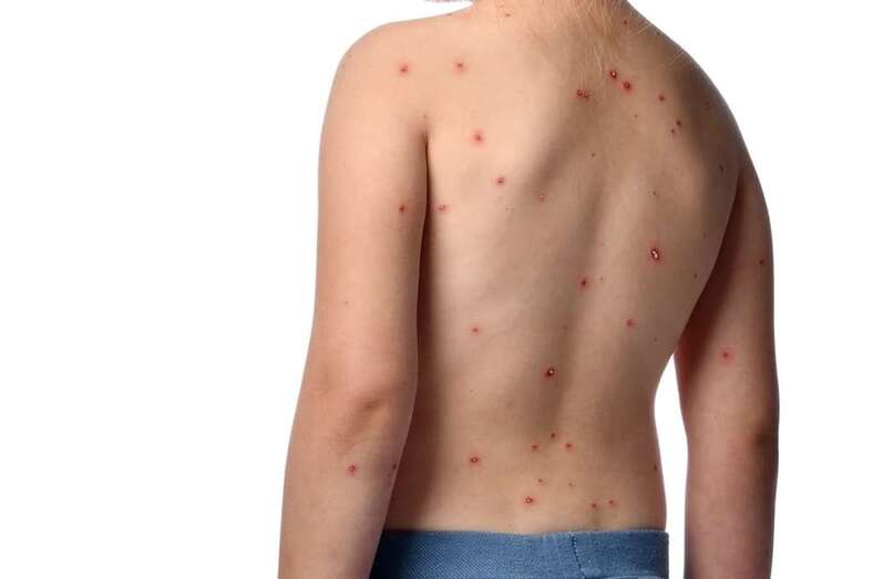 Joven con la enfermedad/Multimedia.