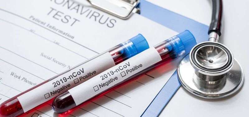 Prueba de coronavirus/TA.