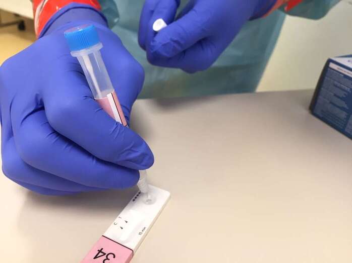 Imagen de archivo de un test covid / TA
