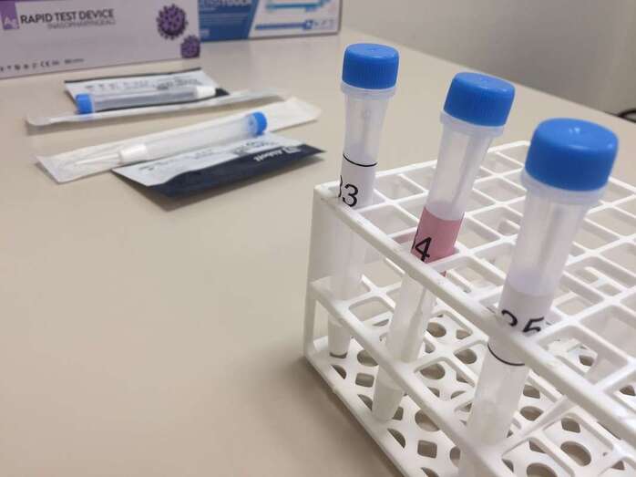 Imagen de archivo de unas pruebas diagnósticas del covid-19 / TA