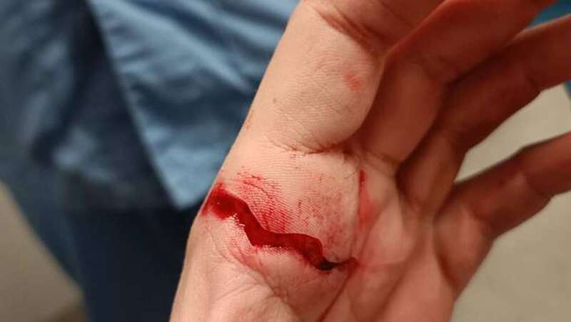 Imagen del corte en la mano/TA.