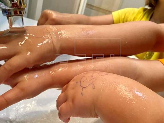 Dos niñas de Las Palmas de Gran Canaria se lavan las manos hasta conseguir limpiarse 