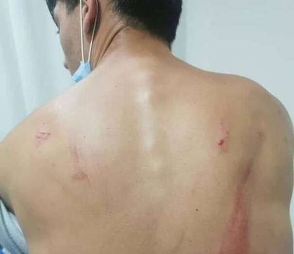 Imagen de las heridas causadas/TA.