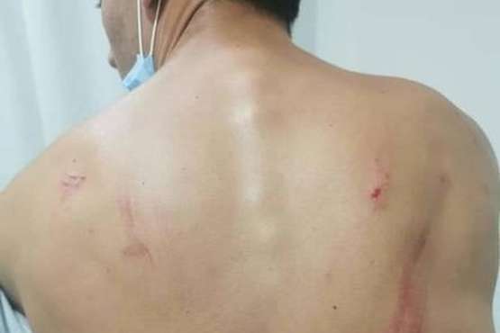 Un grupo de menores magrebíes le pega una paliza a un joven en Mogán/TA.