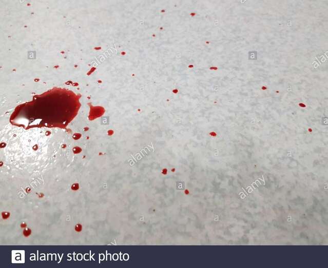 Restos de sangre en el suelo/TA.