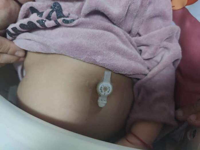 Marta padece una enfermedad rara/TA.