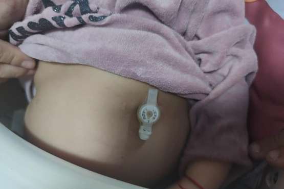 Marta, una niña de 3 años con una enfermedad rara única en el mundo, pide ayuda porque necesita un coche adaptado/TA.