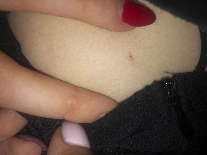 Pinchazo a una mujer/Multimedia.