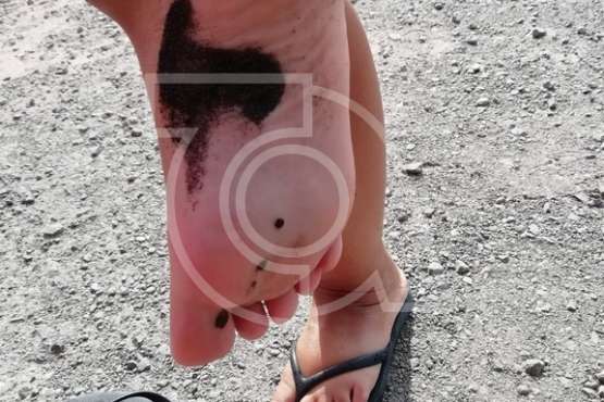 Usuarios de Playa del Hombre denuncian manchas negruzcan que asocian a un vertido (Foto TA)