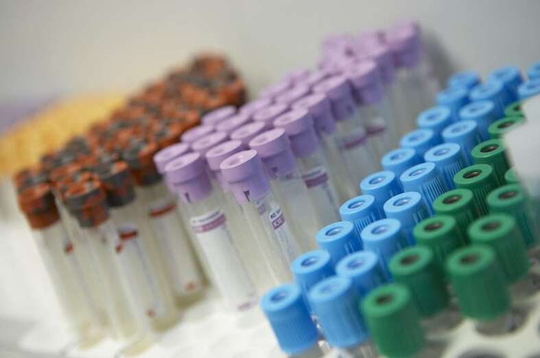 Tubos para la sangre (Foto TA)