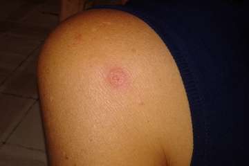 Gallos y gatos colonizan el parque urbano de San Juan-Telde (Foto TA)