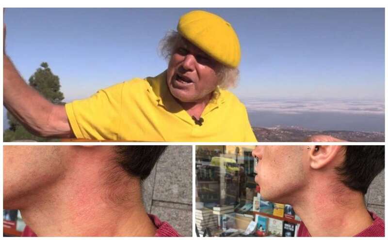 Imagen del joven con las marcas de la supuesta agresión (Foto TA)