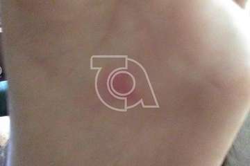 La Garita alerta de una plaga de pulgas en un solar próximo a la playa (Foto TA)