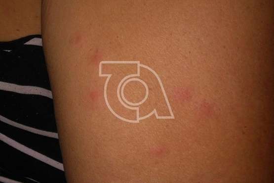 La Garita alerta de una plaga de pulgas en un solar próximo a la playa (Foto TA)