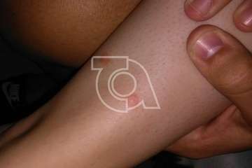 La Garita alerta de una plaga de pulgas en un solar próximo a la playa (Foto TA)