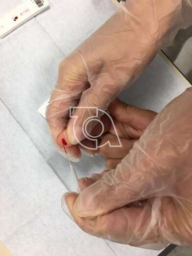 Toma de sangre en la primera de las pruebas del estudio (Foto TA)