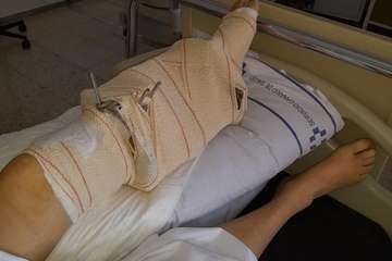 El lamento de una vecina de Telde: 