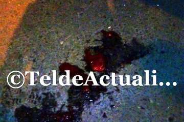 Un hombre sufre un fuerte golpe en la cabeza tras sufrir una caída en Jinámar-Telde (Foto TA)