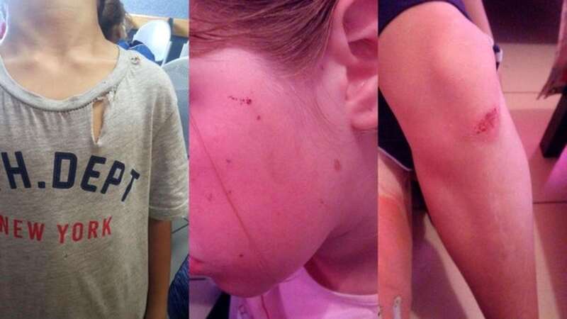 En la imagen, las lesiones que las madres achacan al incidente con la vecina (Foto TA)