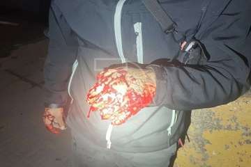 Tiroteo en Lomo de las Brujas de Jinámar con dos heridos/TA.