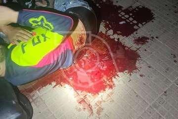 Heridas recibidas por Manuel Artiles/TA y C7.