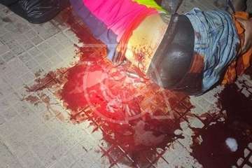 Heridas recibidas por Manuel Artiles/TA y C7.