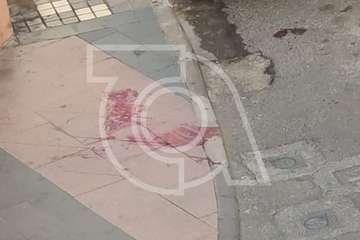 Pelea callejera en Los Llanos de Telde con un herido con varios cortes y contusiones/TA.