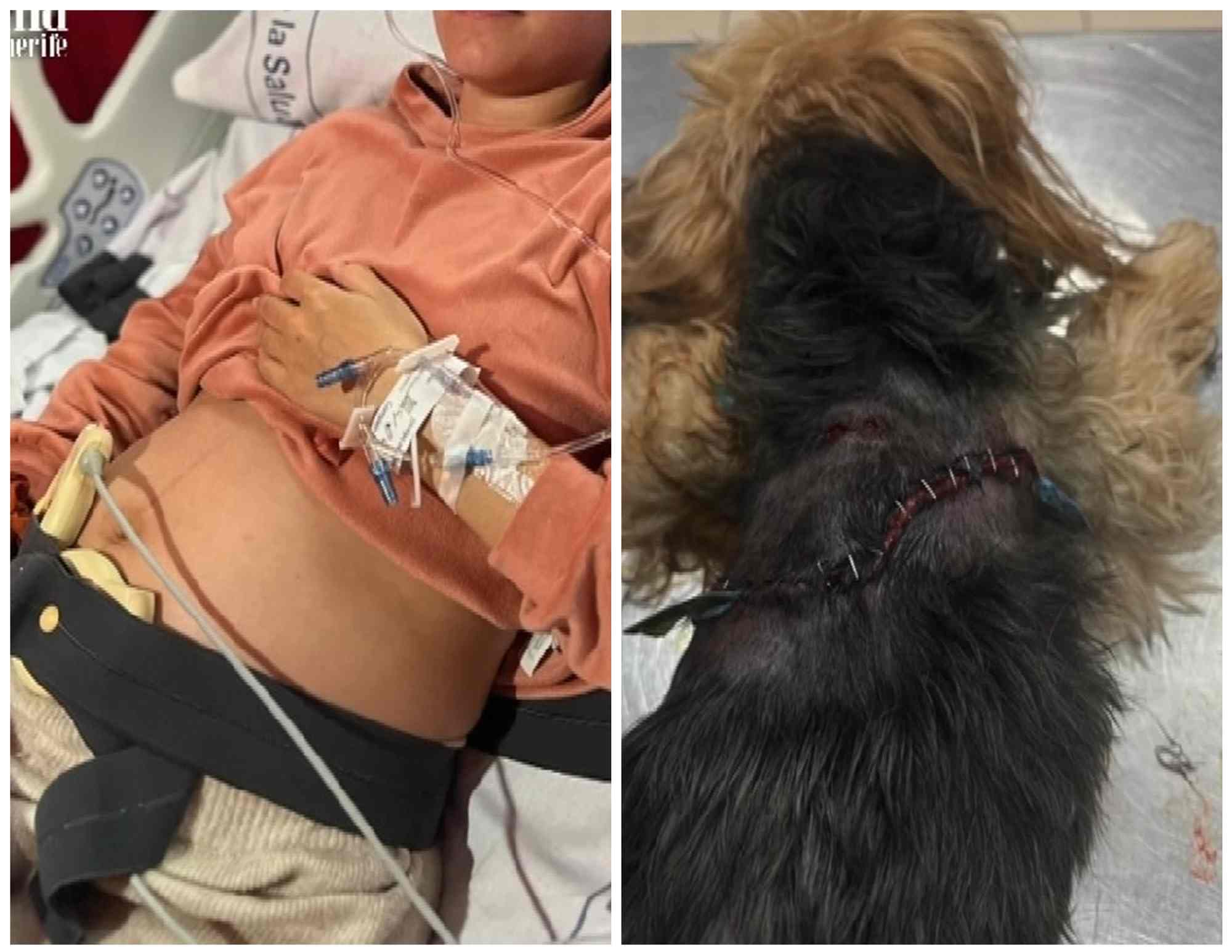 Conmoción en el Valle de los Nueve por el ataque de un pitbull a una gestante y  mascota